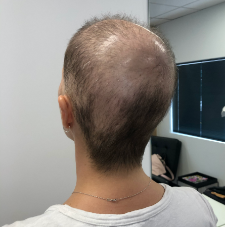 before-image
