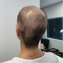 before-image